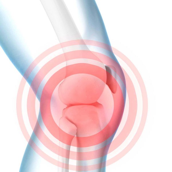 Illustration der Anatomie dies Knies bei Knieschmerzen. Schmerzen im Knie sollten ernstgenommen und mit einem Arzt abgeklärt werden.