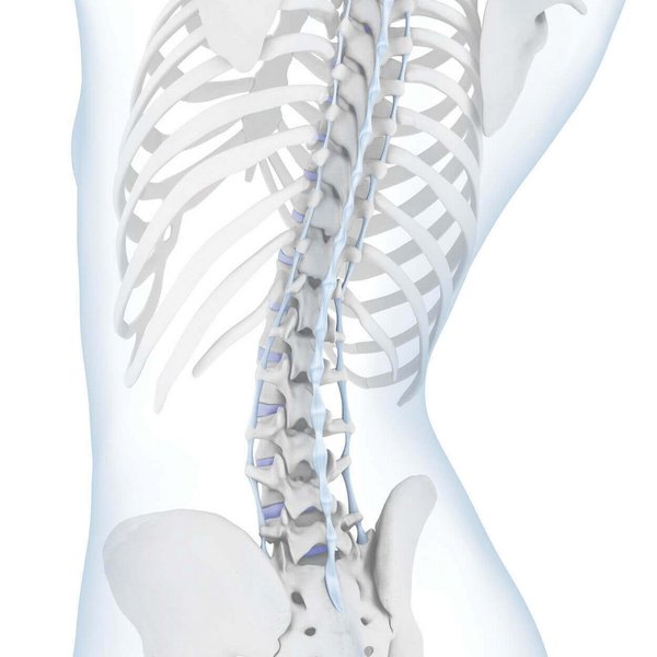 Weergave van de anatomie van de wervelkolom bij een aanwezige holle rug. Bij een holle rug gaat het om een extreem sterke kromming van de lendenwervelkolom. Opvallend daarbij is dat zowel de buik als het bekken zich duidelijk naar voren welven.