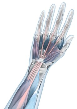 Weergave van de anatomie van de arm met een muisarm-aandoening (RSI-syndroom).