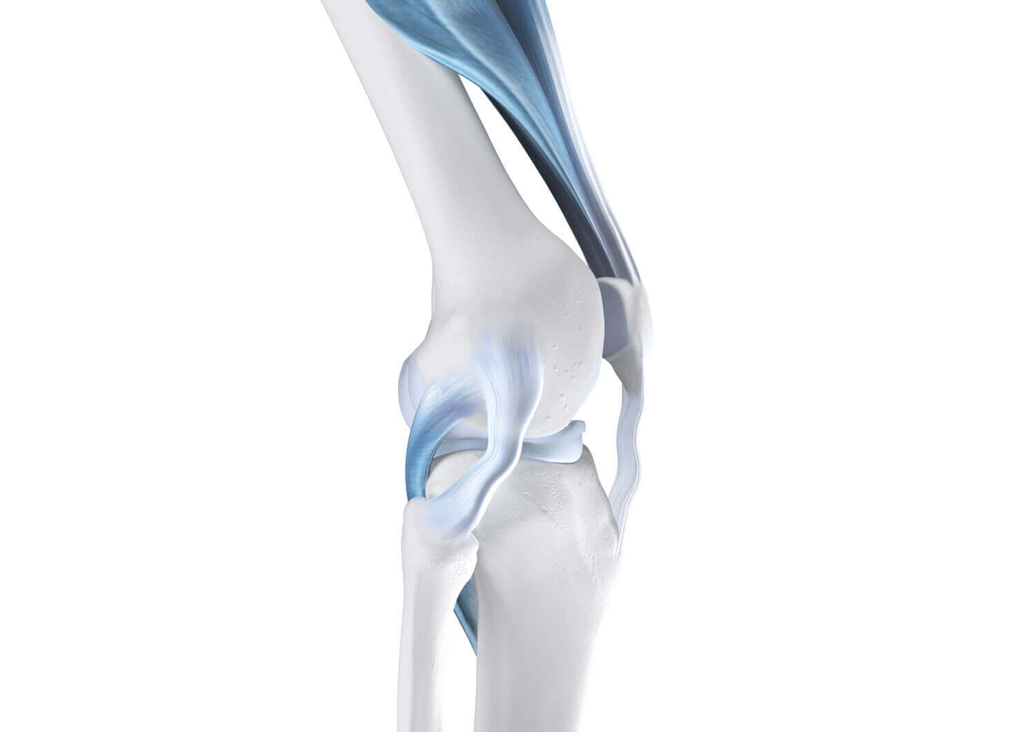 Weergave van de anatomie van de knie bij een instabiel kniegewricht.