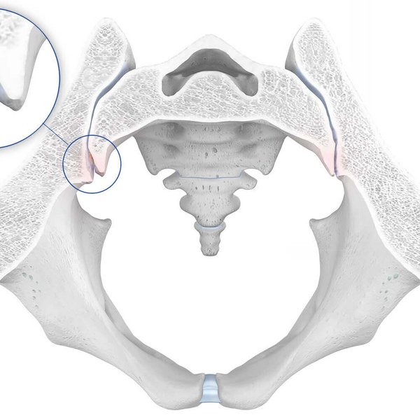 Illustratie van de anatomie van de heup bij een spondylartrose.
