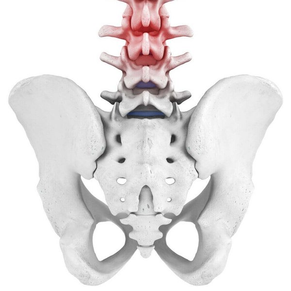 Weergave van de anatomie van de wervelkolom bij een aanwezig LWK-syndroom. Onder een acuut LWK-syndroom, in de volksmond ook spit genoemd, verstaat men een heel plotseling optredende, zeer hevige en stekende pijn in het gebied van de lendenwervelkolom.