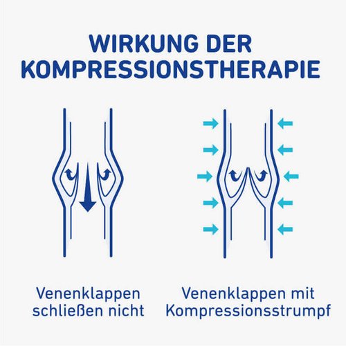 Een illustratieve afbeelding van de werking van de compressiebehandeling.