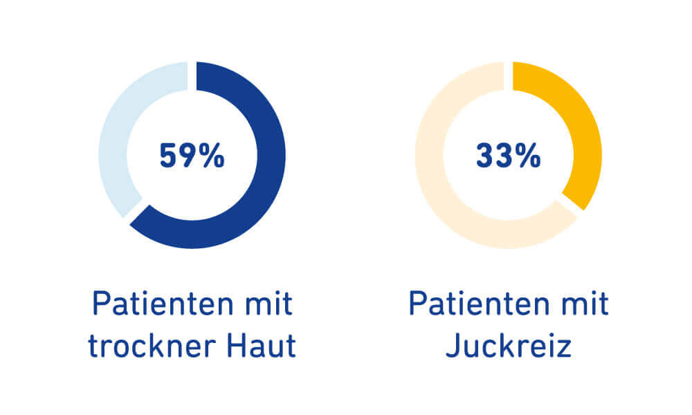 De afbeelding toont een statistiek. 59% van de patiënten heeft een droge huid. 33% van de patiënten heeft een jeukende huid.